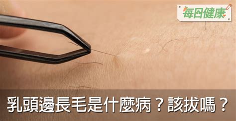 乳頭周圍長毛|乳頭邊長了毛，是什麼病？該不該拔？讓名醫一次解釋給您聽｜每